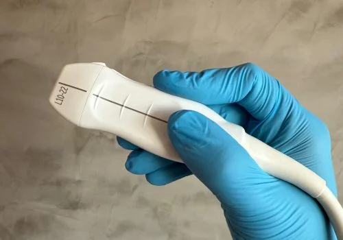 Ultrassonografia dermatológica de alta precisão